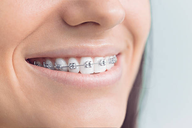 Best Teeth Whitening  in Riverview, FL